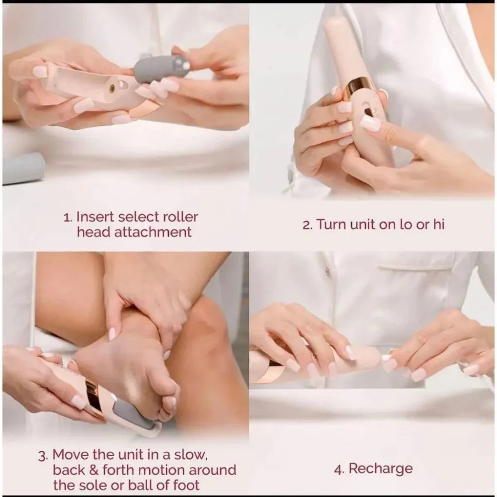 Removedor Profissional De Calos Lixador de Pé Elétrico Recarregável USB Portatil