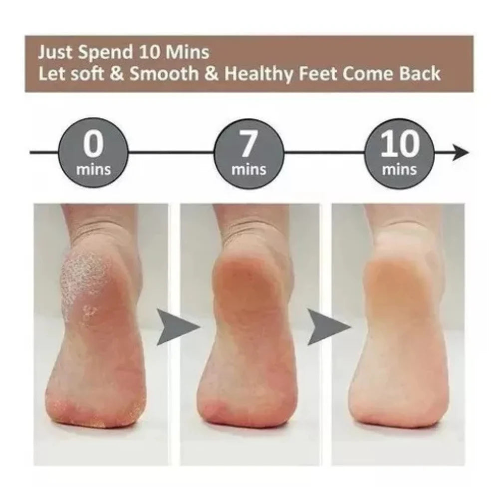 Removedor Profissional De Calos Lixador de Pé Elétrico Recarregável USB Portatil